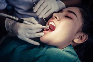 Visita al dentista regularmente