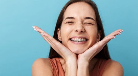 braquets Ortodoncia para aultos
